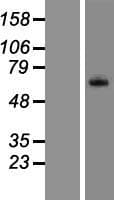 Human Complement C8b Protein (Over-Expression Lysate Myc-DDK (Flag))