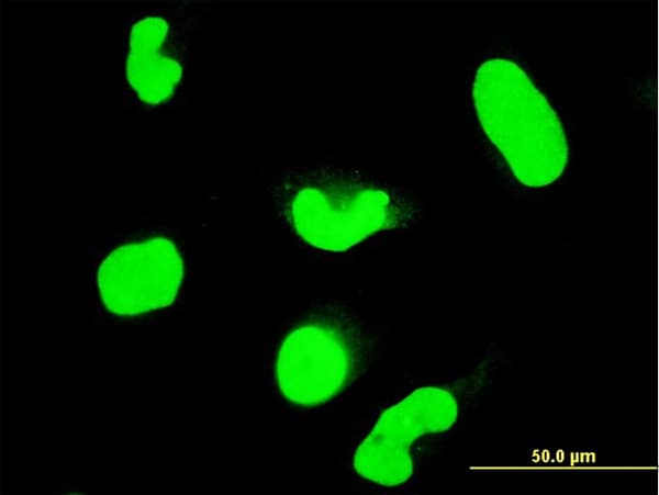 IHC-plus™ STAT6 Antibody (clone 6C10)