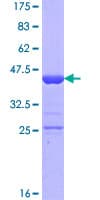 Human PDRG1 Protein (Recombinant GST)