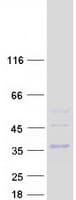 Human CLEC4E / MINCLE Protein (Recombinant Myc-DDK (Flag))