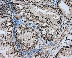 DAPK2 / DAP Kinase 2 Antibody (clone OTI1C8)