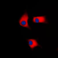 CSNK1G2 / CKI-Gamma 2 Antibody (N-Terminus)