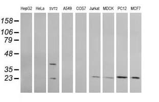 RAB30 Antibody (clone OTI1B2)