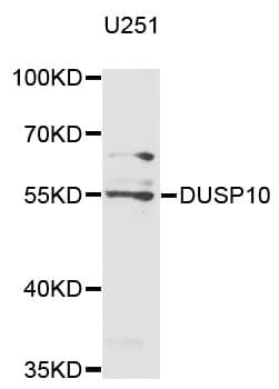Polyclonal Rabbit anti-Human DUSP10 / MKP5 Antibody (WB)