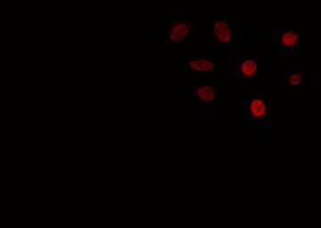 Polyclonal Rabbit anti-Human ISL2 / Islet 2 Antibody (IF, WB)