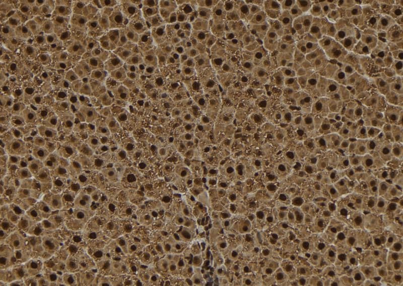 TPX2 Antibody