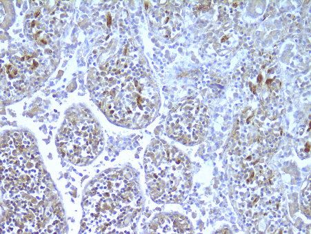 Monoclonal Mouse anti-Human NOD2 / CARD15 Antibody (IHC, WB)