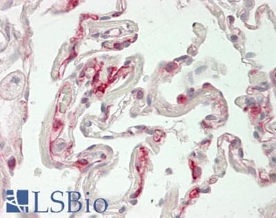 IHC-plus™ THBD / CD141 / Thrombomodulin Antibody (C-Terminus)