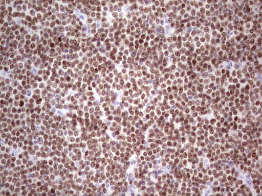 Monoclonal Mouse anti-Human IKZF3 / AIOLOS Antibody (clone OTI4H7, Carrier-free, aa1-301, IHC, WB)