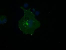 FCGR2 / CD32 Antibody (clone OTI16D6)
