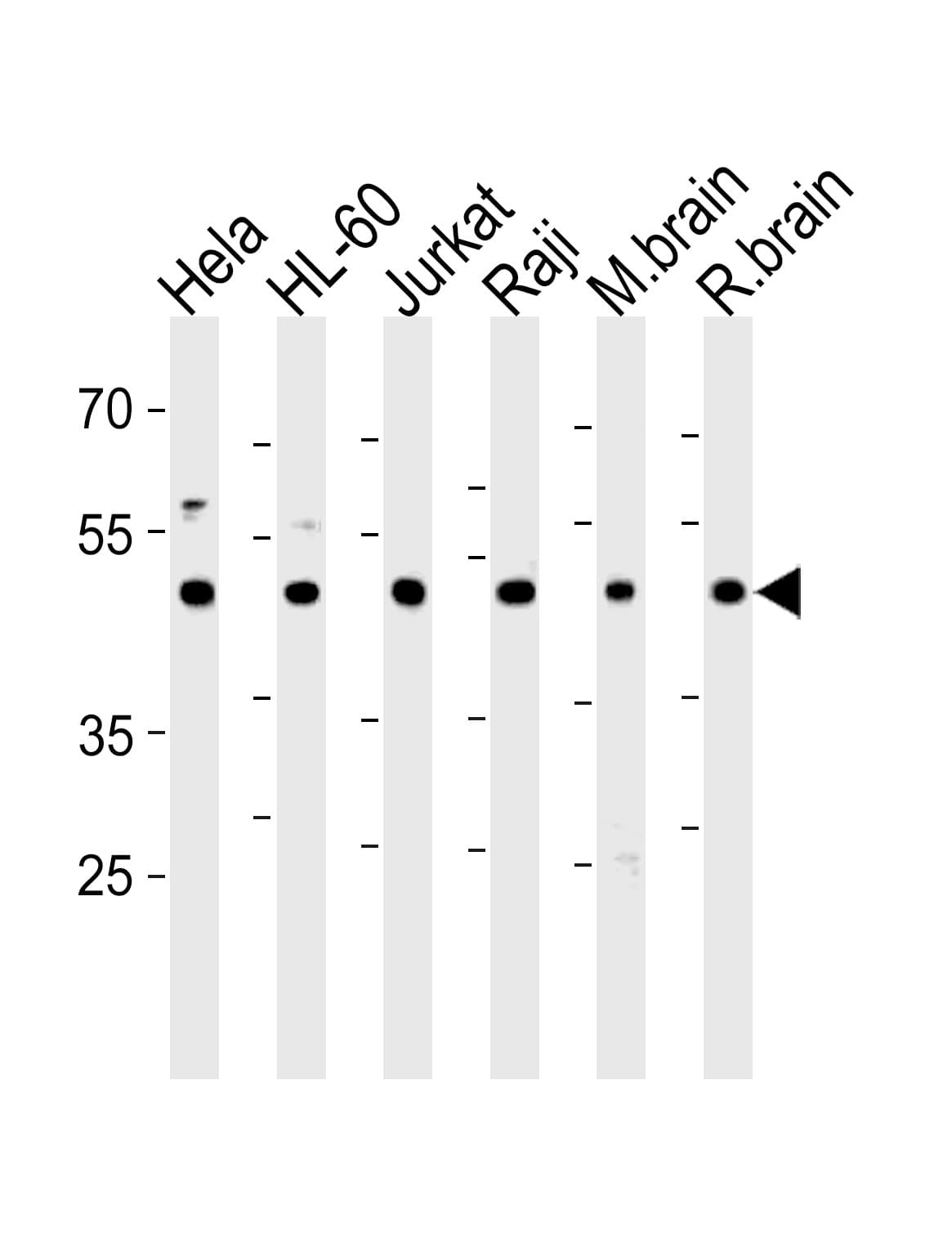 Polyclonal Rabbit anti-Human CTBP1 / CTBP Antibody (aa413-440, IF, WB)