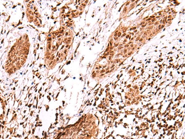 AK9 / AKD1 / AKD2 Antibody