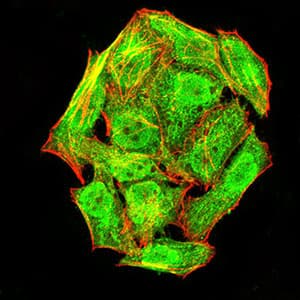 Monoclonal Mouse anti-Mouse IPAF / NLRC4 Antibody (clone 4B7B7, aa525-538, pSer533, IHC, WB)