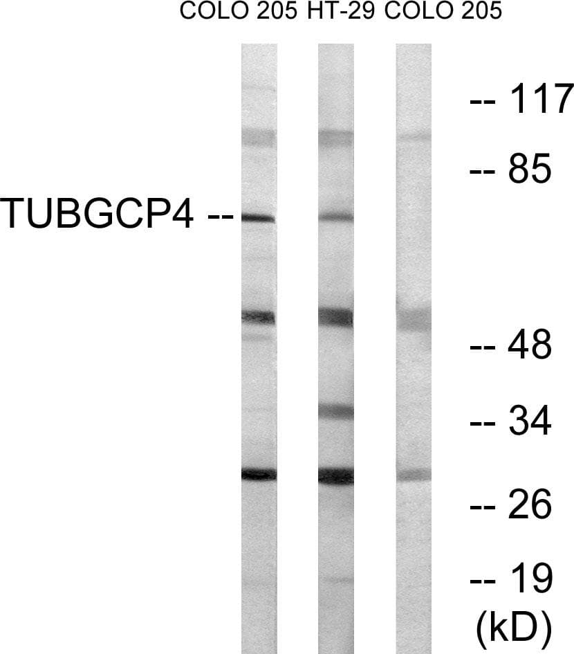 Polyclonal Rabbit anti-Human TUBGCP4 Antibody (WB)