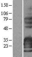 SYNPR / Synaptoporin Protein (Over-Expression Lysate Myc-DDK (Flag))