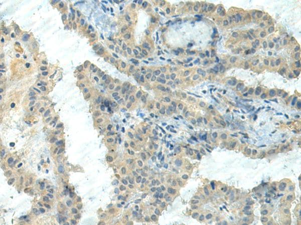 CTDP1 / FCP1 Antibody