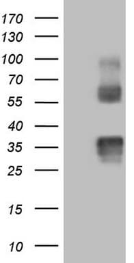 PROCR / EPCR Antibody (aa1-210, clone OTI5A8)