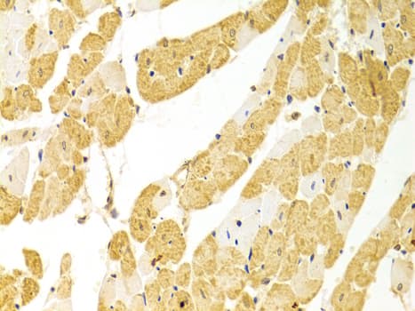 PLCB1 / Phospholipase C Beta 1 Antibody