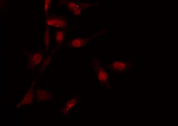 DATF1 / DIDO1 Antibody