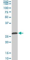 MTAP Antibody (clone 2G4)