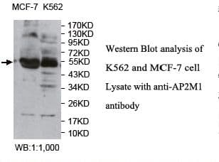 AP50 / AP2M1 Antibody (aa11-215)