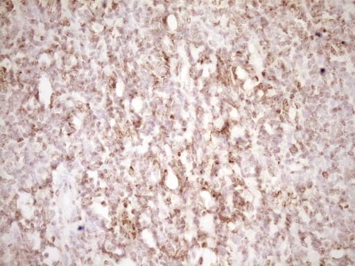 LPIN1 / Lipin 1 Antibody (clone OTI8F10)
