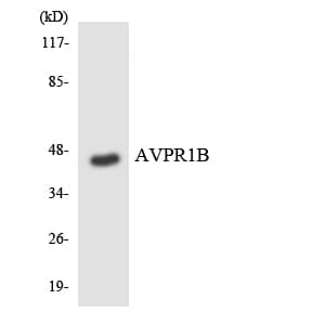 AVPR1B Antibody (aa265-314)