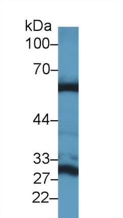 GLS2 / Glutaminase 2 Antibody (aa154-479)