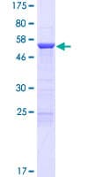 Human CCDC103 Protein (Recombinant GST)