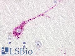 PathPlus™ TAAR5 Antibody (Extracellular Domain)