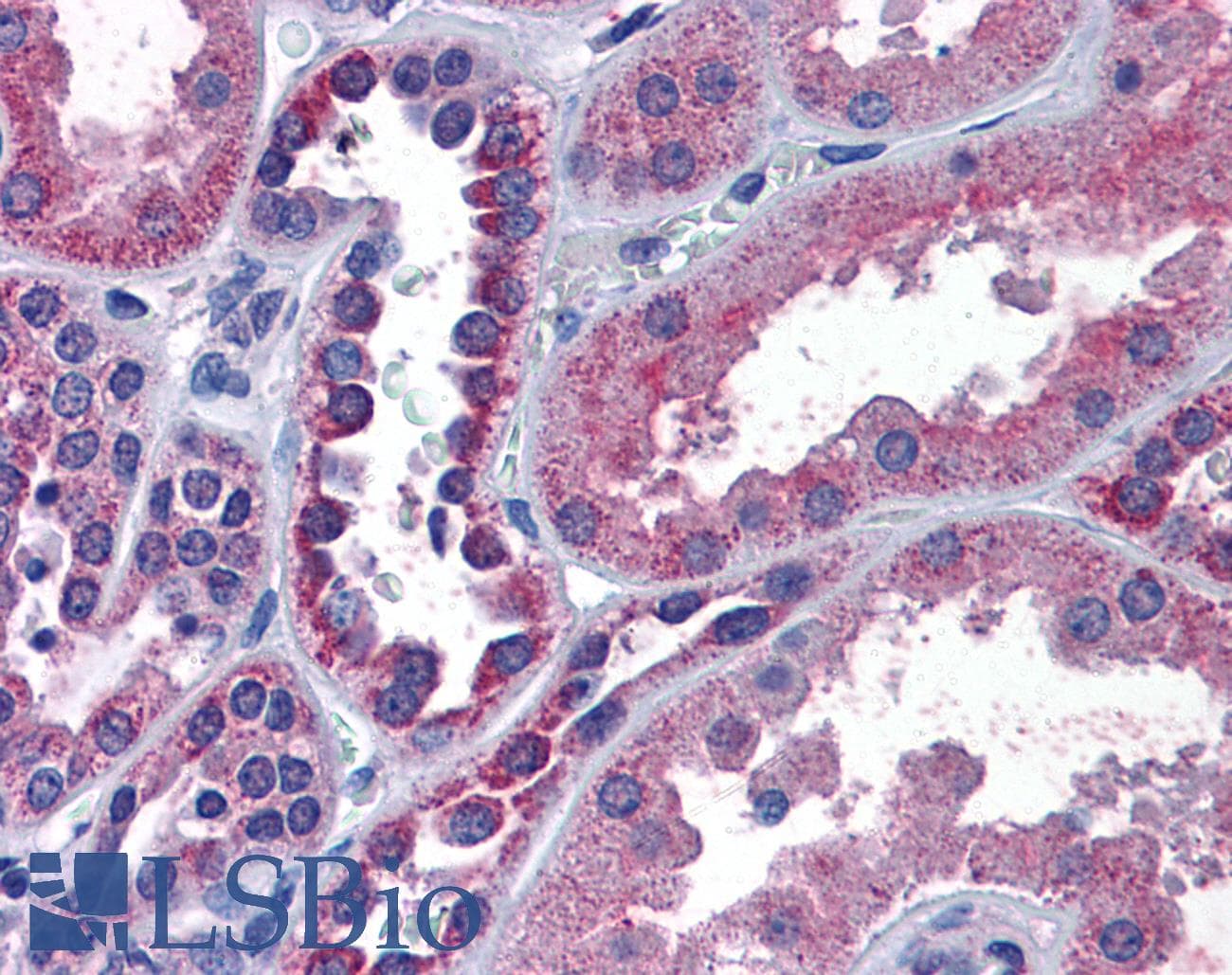 IHC-plus™ Polyclonal Goat anti-Human IREB2 / IRP2 Antibody (aa489-503, IHC, WB)