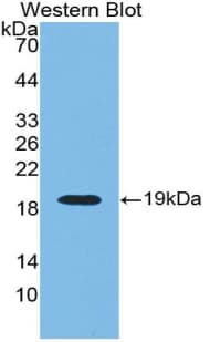 RNLS / Renalase Antibody (aa18-150)