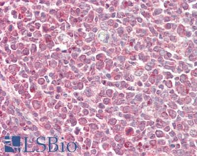 IHC-plus™ ITPR3 Antibody (aa625-675)
