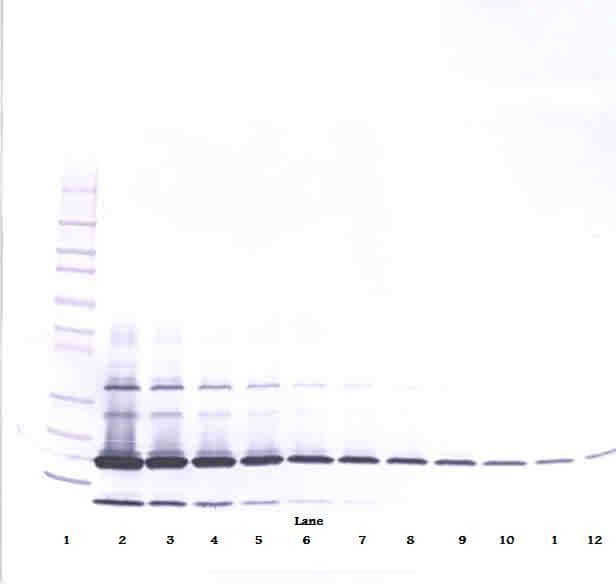 IHC-plus™ Monoclonal Mouse anti-Human RETN / Resistin Antibody (IHC, WB)