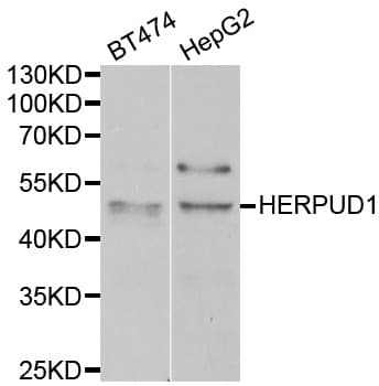 HERPUD1 / HERP Antibody