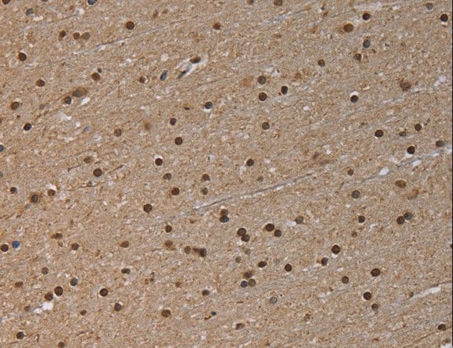 NALP6 / NLRP6 Antibody