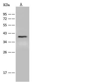 Polyclonal Rabbit anti-Human GPR55 Antibody (Preservative Free, WB)