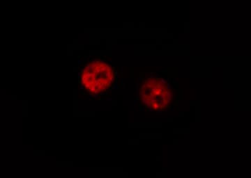 RB1 / Retinoblastoma / RB Antibody (phospho-Ser795)