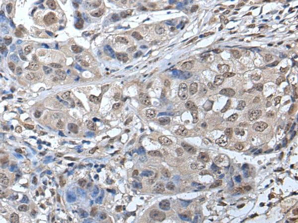 SMC1A / SMC1 Antibody