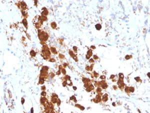 ACTH Antibody (aa1-24, clone SPM333)