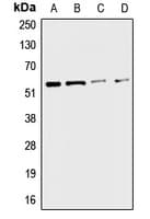 CHRNA3 Antibody (Internal)