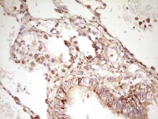 ERBB3 / HER3 Antibody (clone OTI1C6, Carrier-free)
