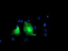 PFKP Antibody (clone OTI1A11)