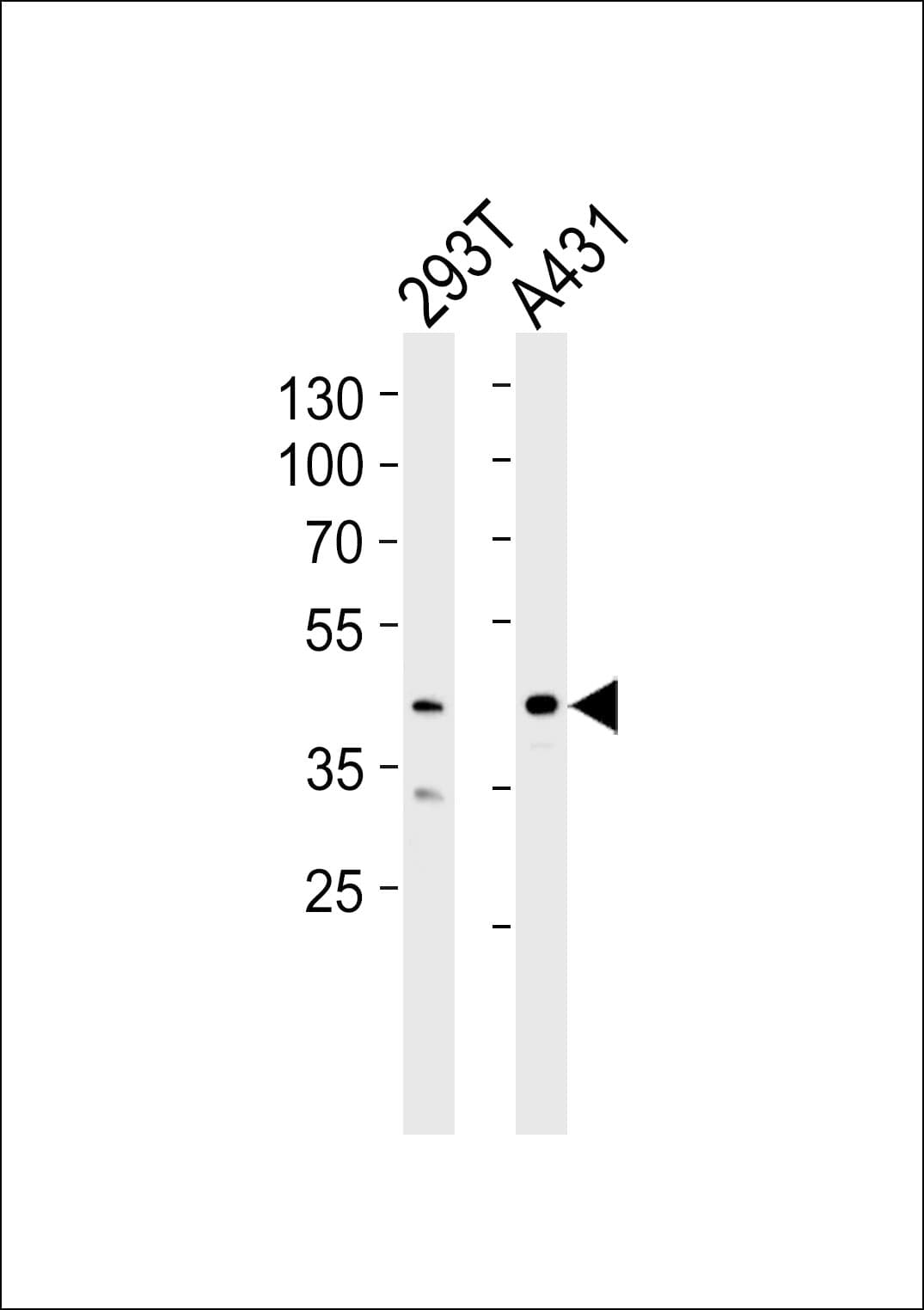 CSNK2A1 Antibody (aa162-195)