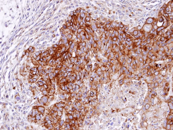 RASGRP4 Antibody (aa108-200)