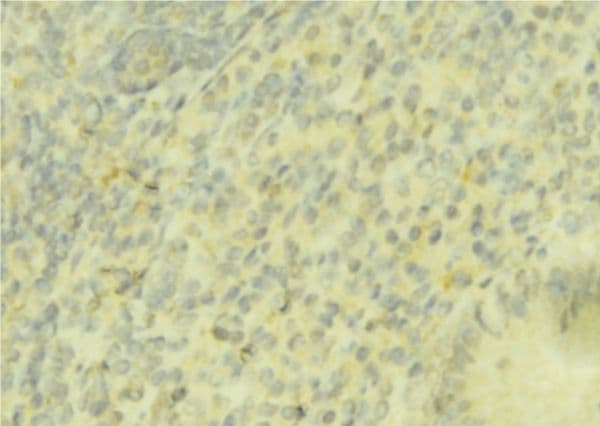 HP / Haptoglobin Antibody