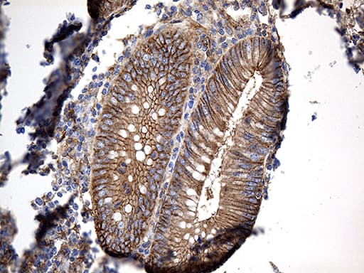 Monoclonal Mouse anti-Human GNA14 Antibody (clone OTI3E8, aa31-348, IHC, WB)