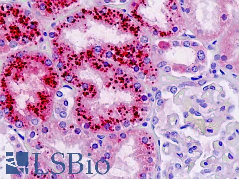 IHC-plus™ STIM2 Antibody (aa98-127)
