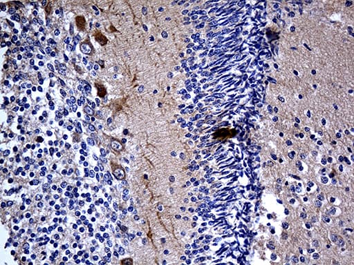 Monoclonal Mouse anti-Human MCF2 / DBL Antibody (clone OTI2C12, aa872-1001, IHC, WB)