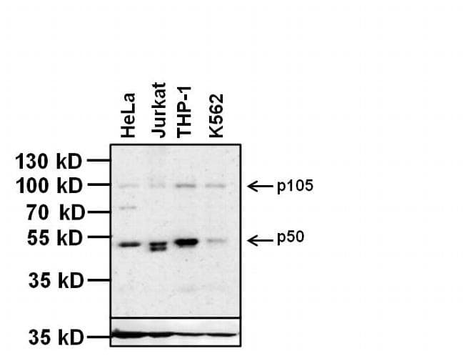 Monoclonal Mouse anti-Human NFKB1 / NF-Kappa-B Antibody (clone 5D10D11, IHC, IF, WB)